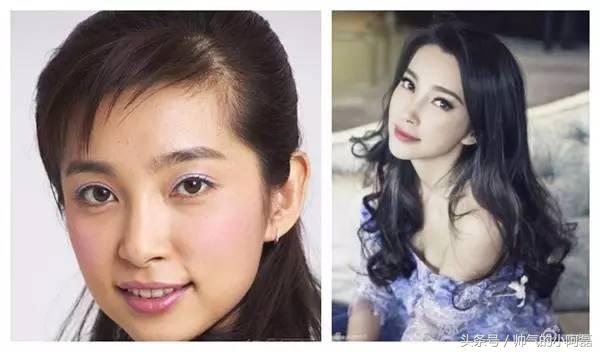 玻尿酸微整形丰下巴多少钱一针,下巴微整形要多少钱