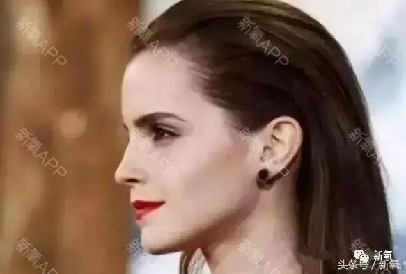 杨紫微整前后容颜对比,杨紫瘦了吗