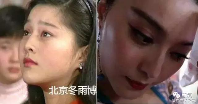 杨紫微整前后容颜对比,杨紫瘦了吗