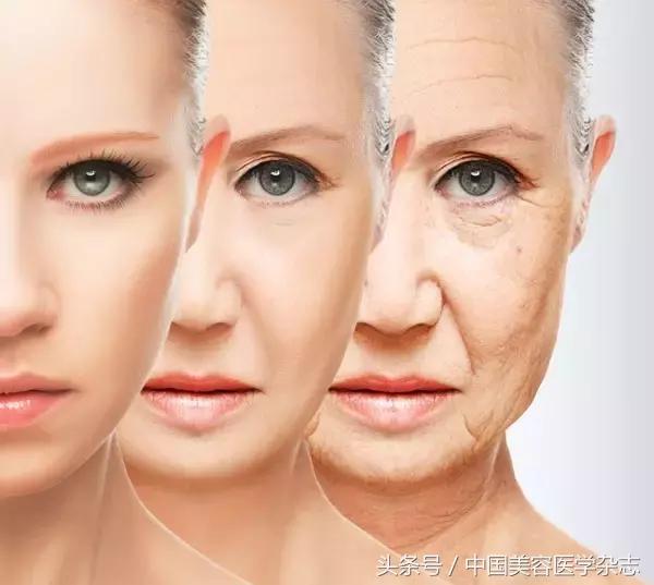 线雕面部提升女的,少女线雕术