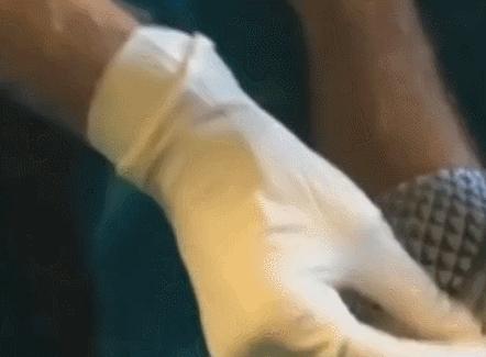 鱼的这个部位千万别吃毒性超强,用鱼皮治烫伤真的可能吗