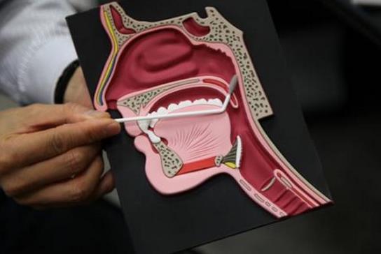 鼻咽癌的早期治愈率可达80以上,鼻咽癌患者最新明细