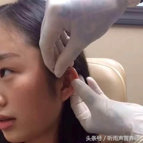 打完耳洞不能沾水,打完耳洞之后不能吃什么