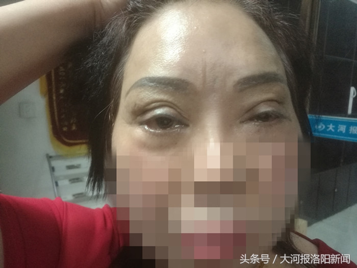 整形有风险需要谨慎,整形有风险能不整就不整