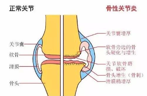 治膝骨关节炎国内最好的医院排名,骨关节前十医院
