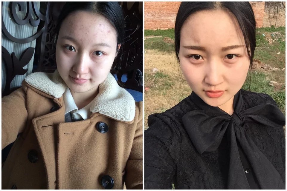 如何排毒祛痘最快最有效,怎么排毒祛痘最有效果