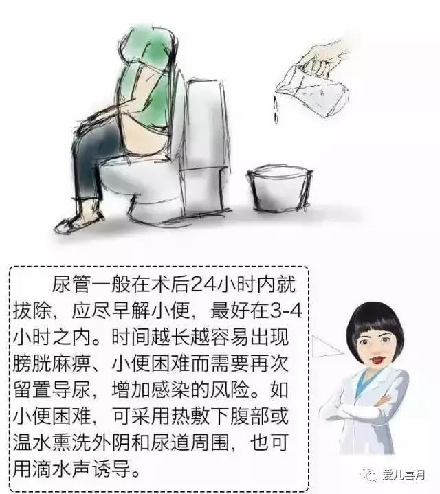 如何画剖腹产,什么是剖腹产手绘画