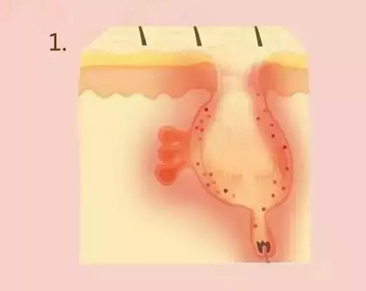 啊！没错，我今天要拯救你们的脸于水火之中！