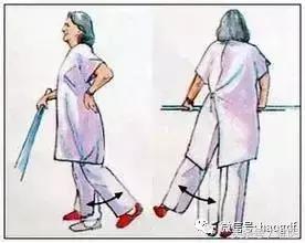 髋关节置换术护理疑难病例讨论,髋关节置换病人的护理与饮食