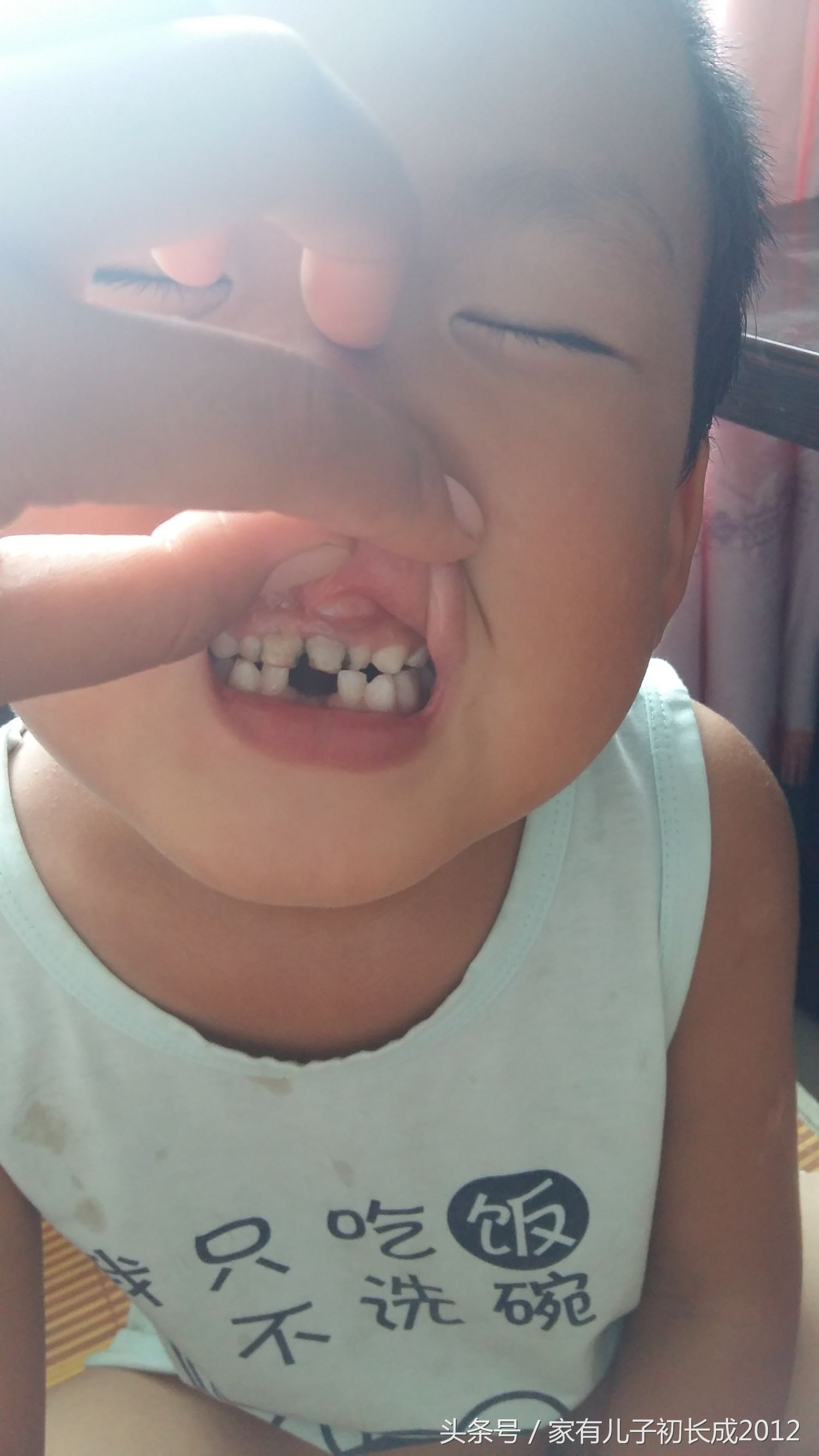 乳牙还没脱落恒牙就萌出了怎么办,6岁孩子乳牙未脱落里面又长新牙