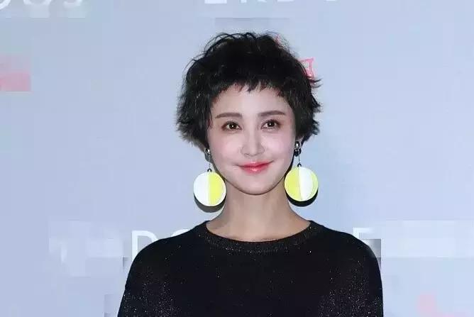 张歆艺打了玻尿酸后的样子,张歆艺下巴打了玻尿酸