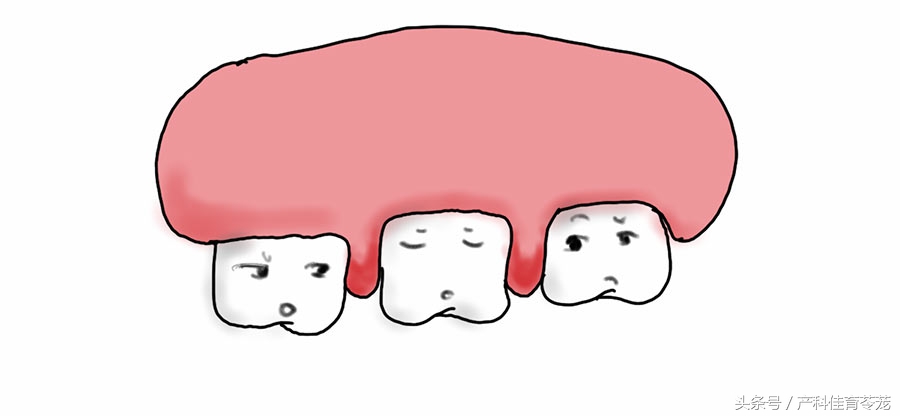 孕期检查口腔,孕期检查你到第几关了