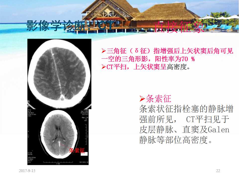 颅内静脉窦血栓形成怎么治疗,颅内静脉窦血栓形成最佳治疗方法