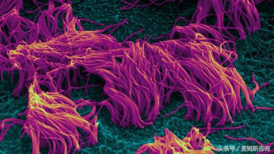 器官芯片技术,器官芯片