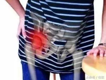 容易误诊成股骨头坏死的疾病,磁共振股骨头坏死有没有可能误诊