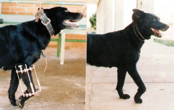 苏联发明断骨增高术,骨科医生神奇疗法