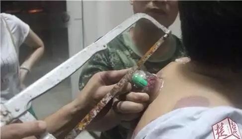 男子做完怎么也拨不了，消防员来了也没办法！最后还得用这个！