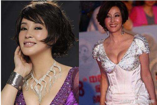 自由基抗衰老方法,抗衰老是仪器好还是手法好