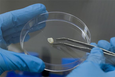 小孩牙周炎自愈的最佳方法,儿童牙周炎能治好吗