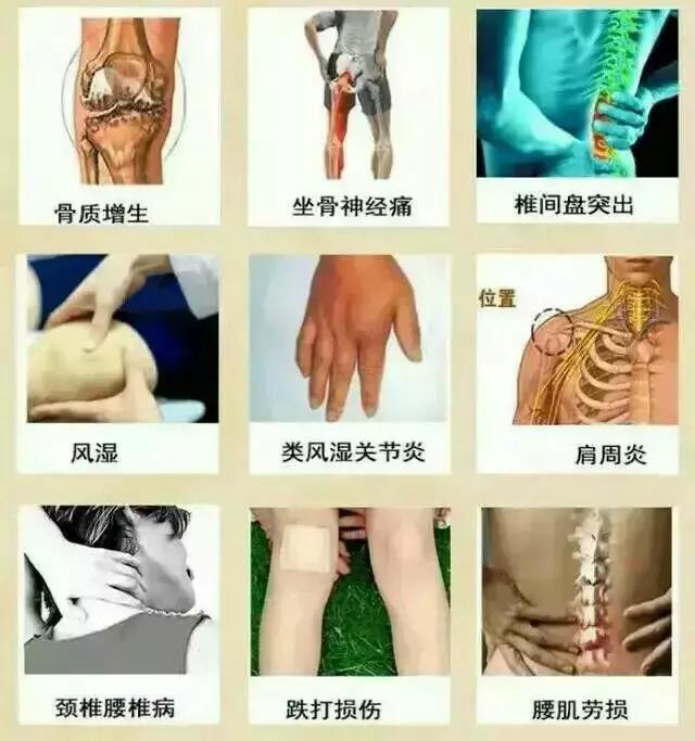 风湿不入骨可以治愈吗,风湿不吃药的情况下该怎么治疗