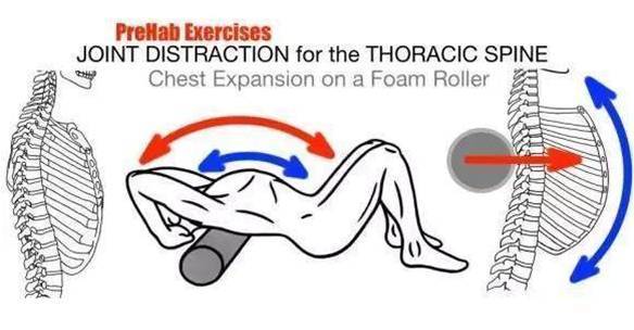 圆肩、驼背、探颈——“上交叉综合症”的纠正方法