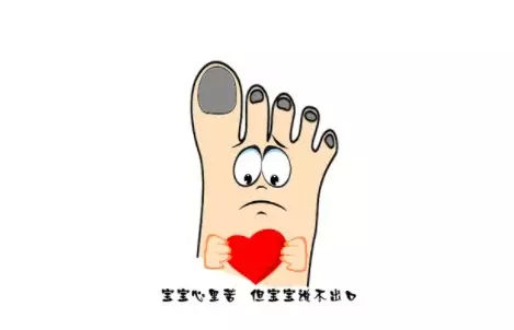 跑步跑出黑指甲该怎么办,跑出黑指甲啥意思