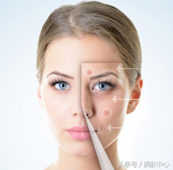 一脸的痘印痤疮,一脸的痘印可以刷酸吗