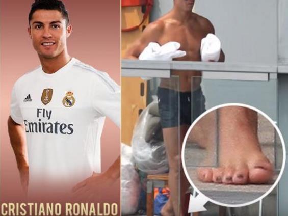 看脚就知道他们为什么是球坛巨星，詹姆斯完全变形，C罗脚趾发肿