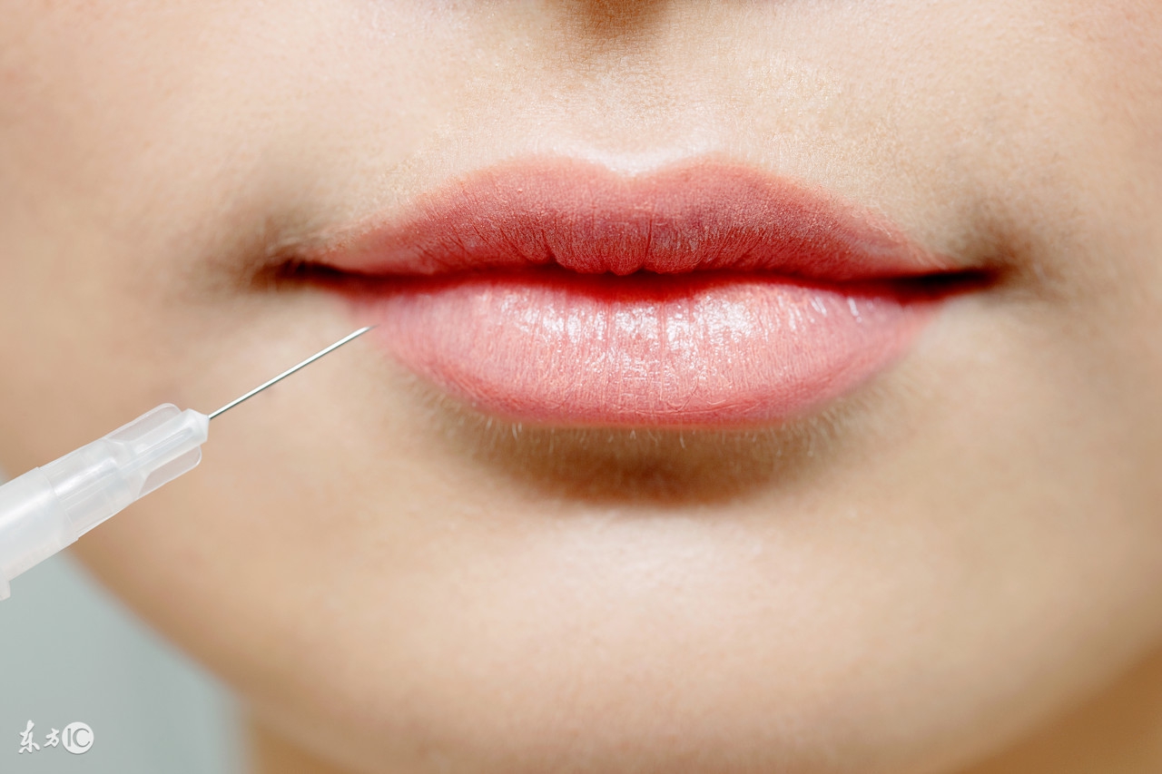 脸部埋线后注意事项有哪些,面部埋线后悔了怎么办