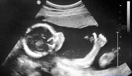 怀孕你不知道的十件事,妈妈怀孕5个月爆出惊人秘密