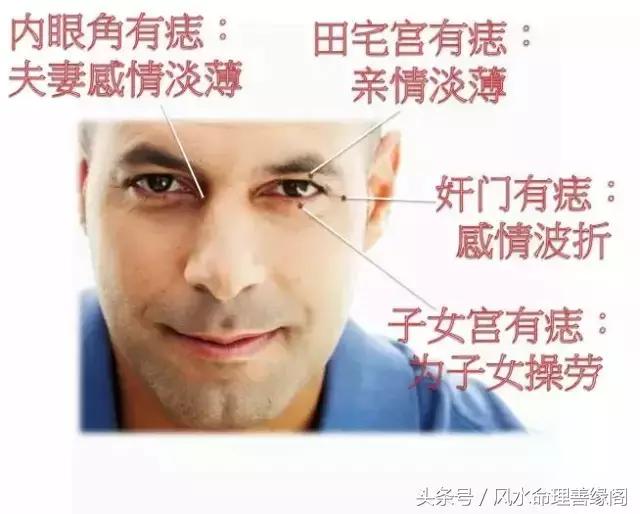 痣长在眼睛旁边是什么意思,眼睛旁边的痣能不能去掉