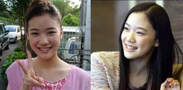 高鼻梁怎么练最有效,如何自然变成高鼻梁的方法学生党