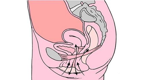 凯格尔运动会变得更硬吗,会阴收缩是不是就是凯格尔运动