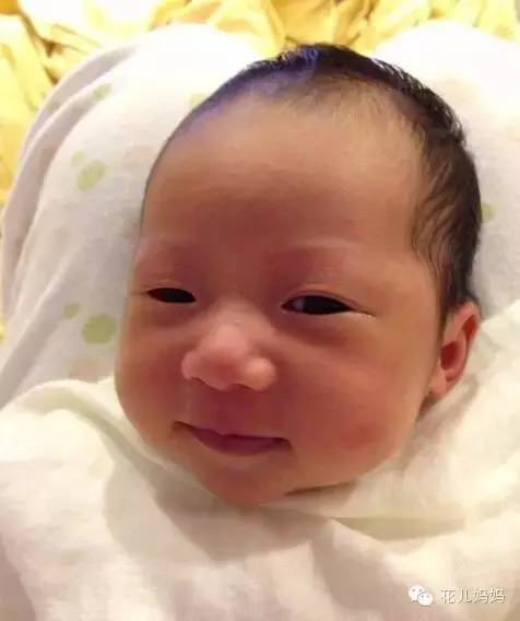 分不清越治越严重！最容易连着得的儿童皮肤病：脂漏性异位性皮