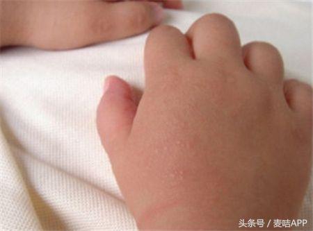 成熟的CTY微囊渗透技术或将扩大修复凝胶的母婴市场份额