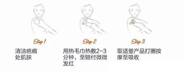 深扒“网红”神油,8周改善妊娠纹和疤痕~