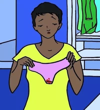 卵巢肿瘤的四种症状,卵巢实性包块的四种症状