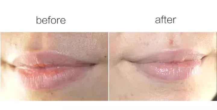 秋冬季节嘴唇干燥起皮怎么办,润唇膏夏季推荐