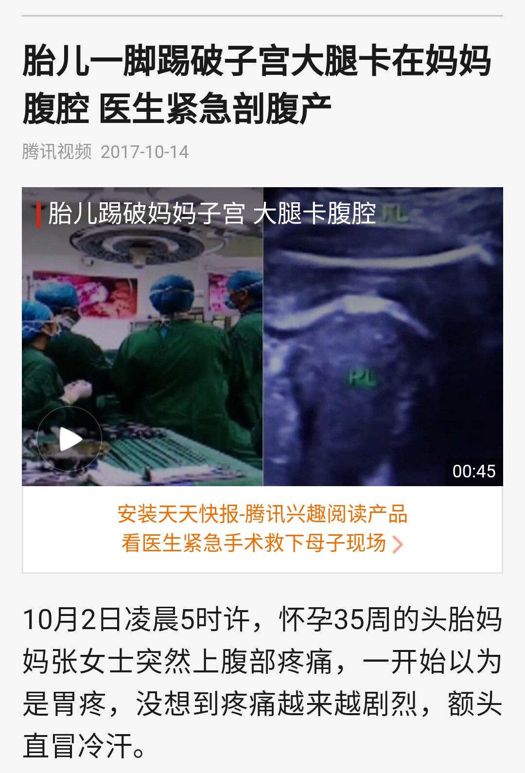 胎儿怎么一脚踢破妈妈子宫,胎儿把胎膜踢破了会怎样