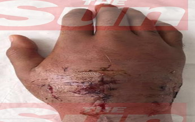 拳击一拳力量,拳击选手一拳的力量