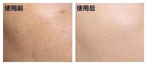 遮瑕效果好的遮瑕排名,化妆店里试用的遮瑕为什么好