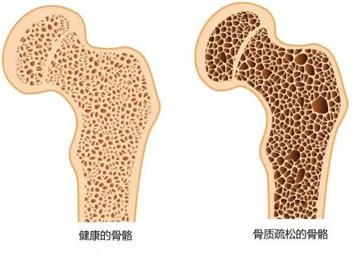 牙齿变灰色要警惕,牙齿变松缺什么