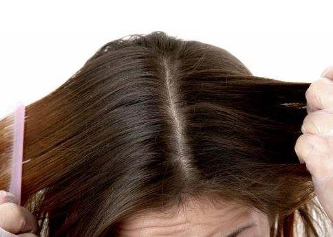 头皮干燥会影响生长吗,头皮干燥是身体缺少什么