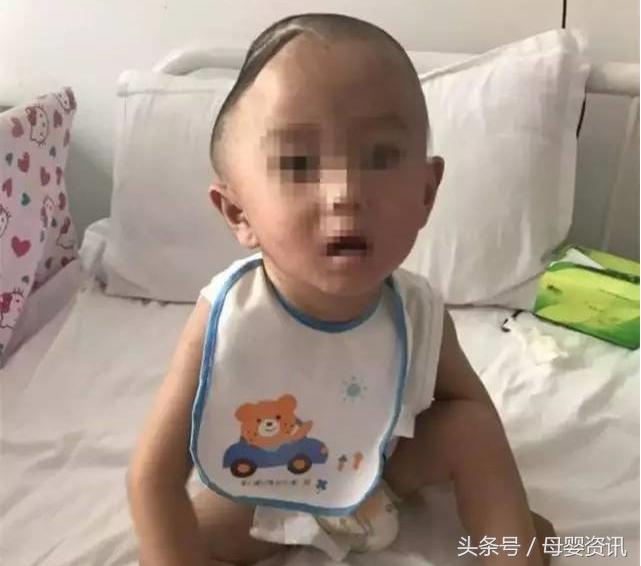 宝宝小时候摔到头长大有后遗症吗,宝宝摔床以后会不会有后遗症