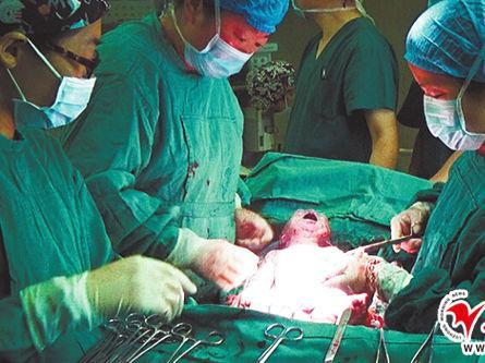 月子里宝宝拉肚子是因为什么原因,月子里的宝宝拉肚子是什么原因