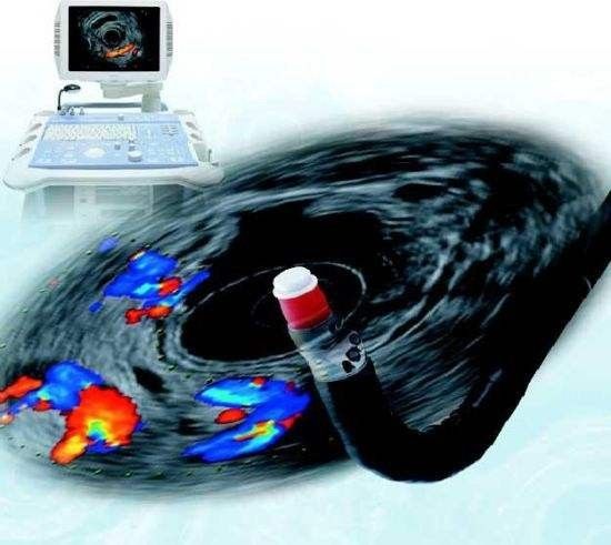 乔布斯胰腺癌几期为何能存活八年,乔布斯为什么死于胰腺癌