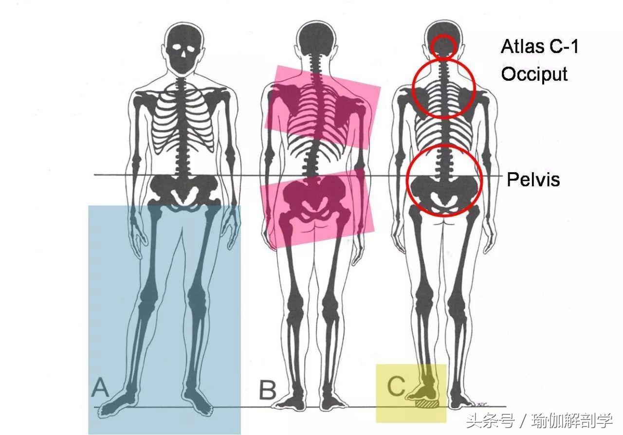 骨盆歪斜导致小便歪,足外翻导致骨盆歪斜