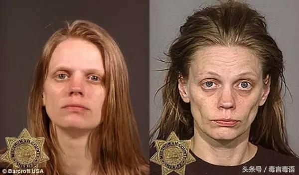 触目惊心吸毒前后真实的变化,吸毒的危害到底有多严重图片