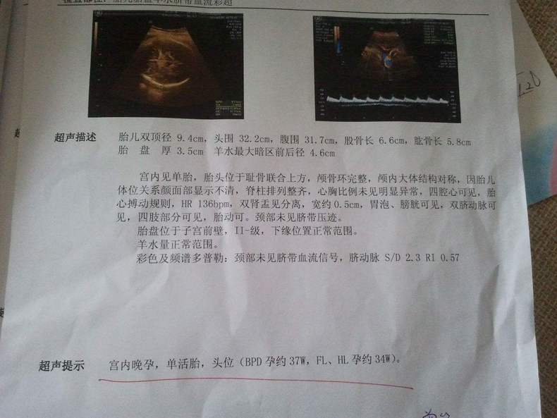 胎儿比实际孕周大啥原因,怎么判断胎儿孕周大小