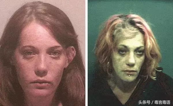 10个吸毒前后的惊人变化,吸毒的人吸毒前后对比图片